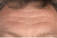 human skin wrinkled 0003